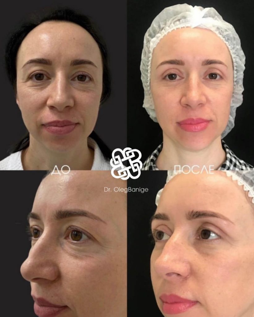 Посмотреть