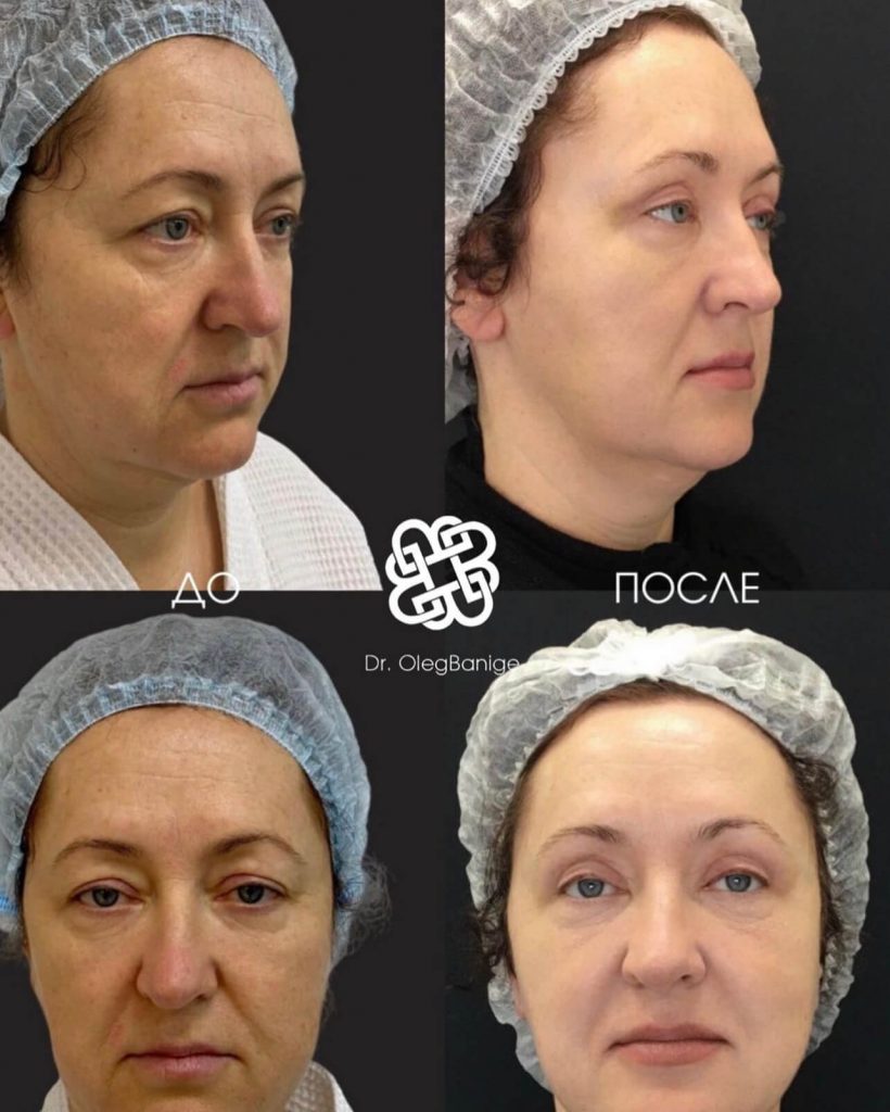 Посмотреть