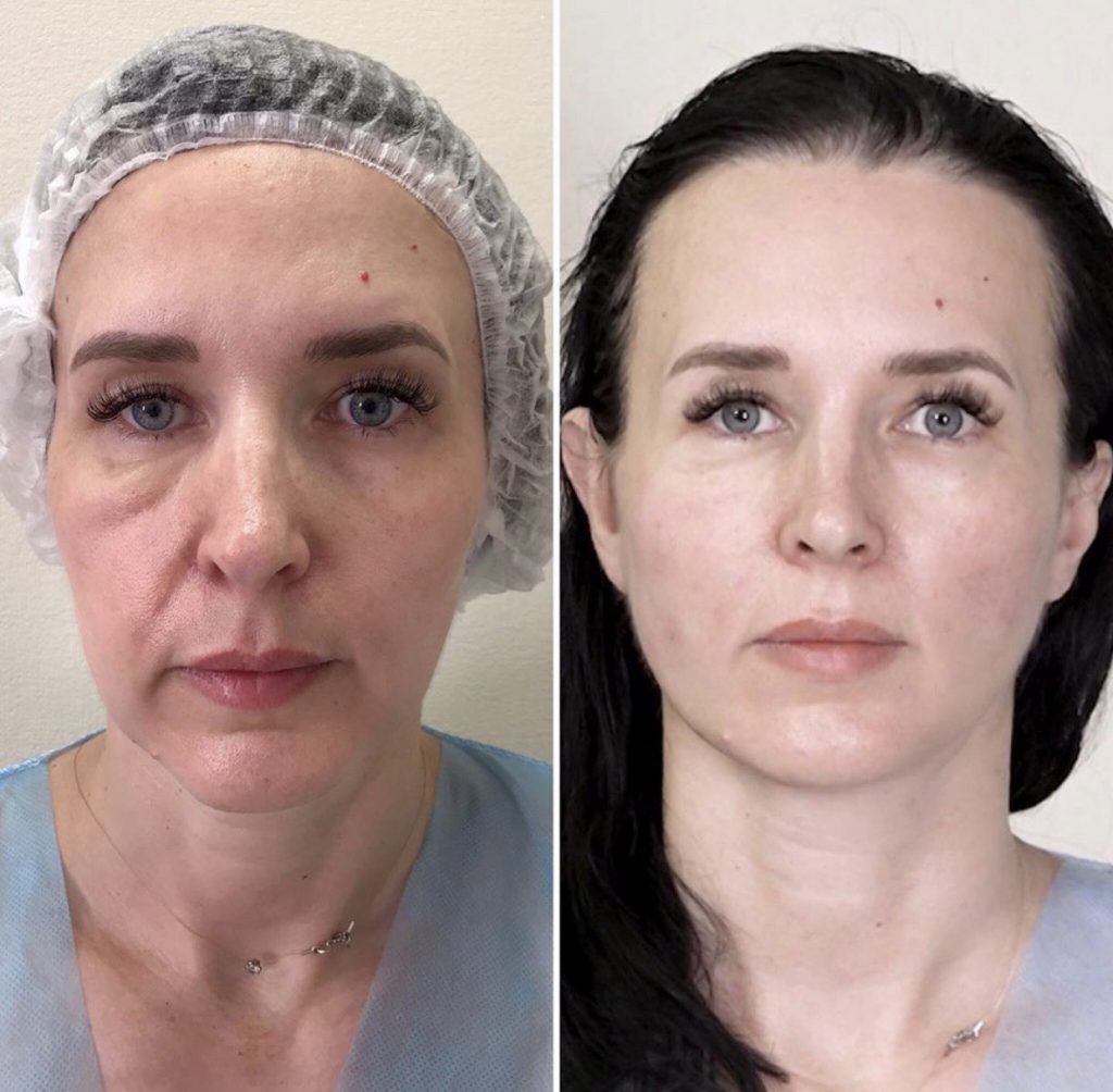 Посмотреть